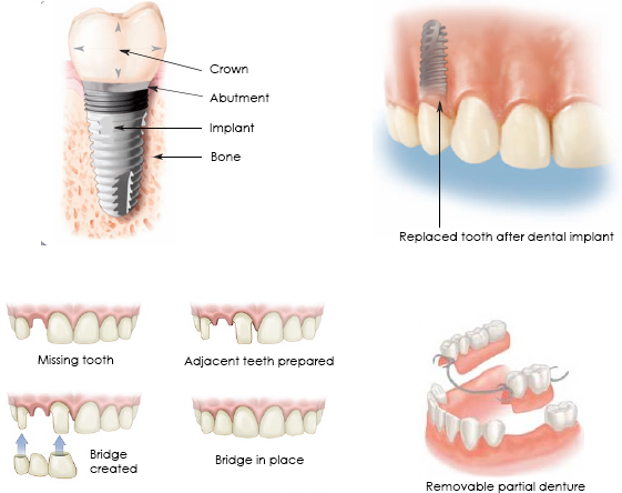 Can all teeth be treated with endodontics?